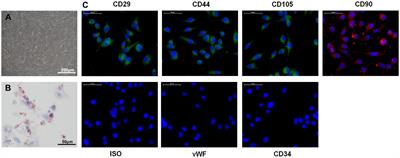 Exosomes Derived From CircAkap7-Modified Adipose-Derived Mesenchymal Stem Cells Protect Against Cerebral Ischemic Injury